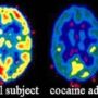 Cerebro sufre daños irreversibles cuando consumo de drogas es en etapas tempranas de la vida