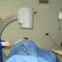 Hipertensos tienen más riesgo de fallecer ante una hemorragia por aneurisma cerebral