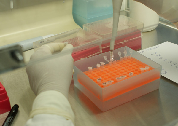 Único centro de investigación en Neurogenética del Perú presentó avances del 2014