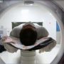 INCN optimizará atención con nuevo tomógrafo de 160 cortes