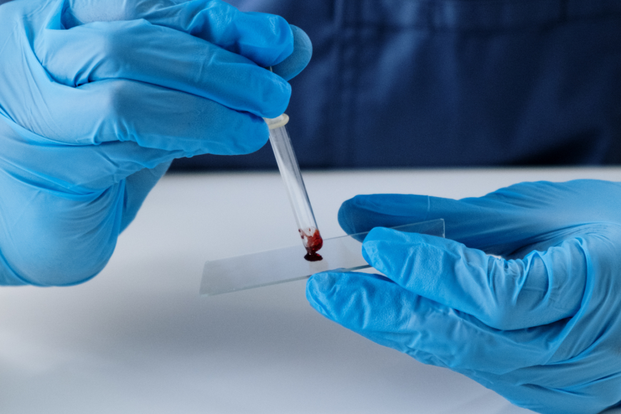 INCN puso en funcionamiento primer Banco de ADN de Neurogenética en el Perú