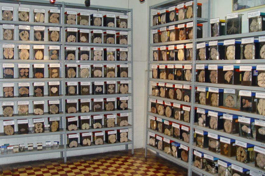 Museo del Cerebro reabrió sus puertas para visitas guiadas