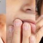 Tics en niños: cuando acudir al especialista